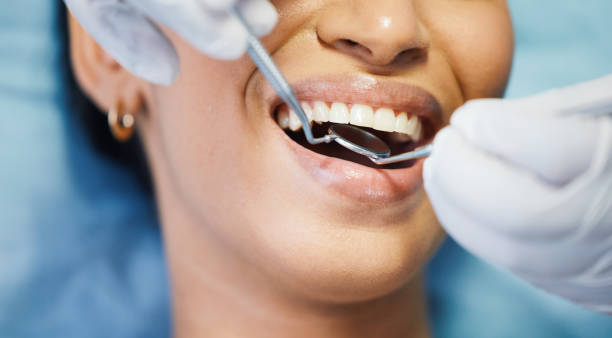 Best Emergency Treatment for Dental Infections or Abscesses in Salem, MO